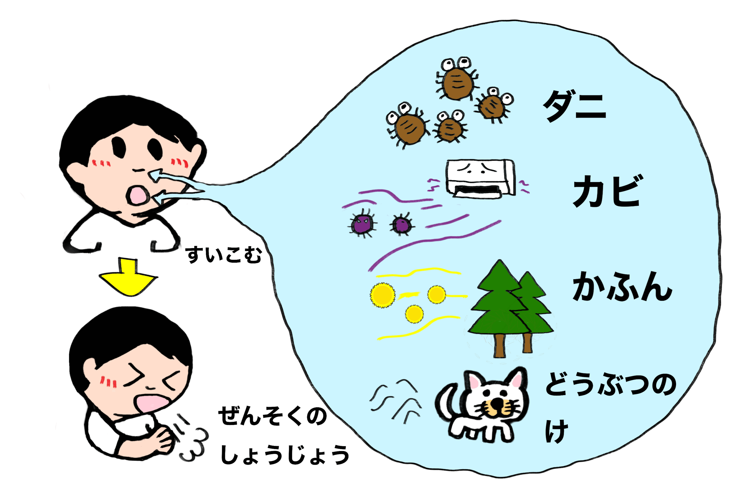 アトピー型ぜんそくと　非アトピー型ぜんそく
